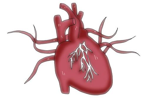 心肌缺血是什么病[治疗方法]怎么引起的原因是什么严重吗？
