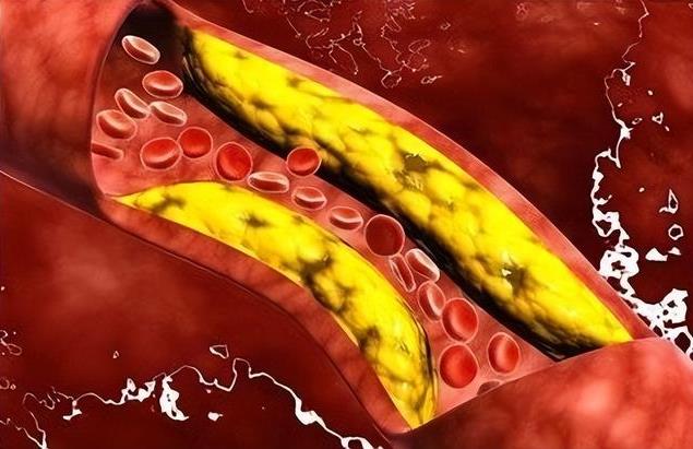哪些营养素可以降低血液中的胆固醇？